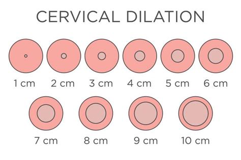 5 Ways Distance Changes During Dilation