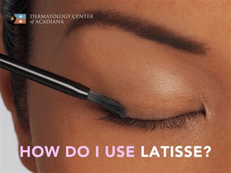 5 Ways To Use Latisse Applicator Correctly