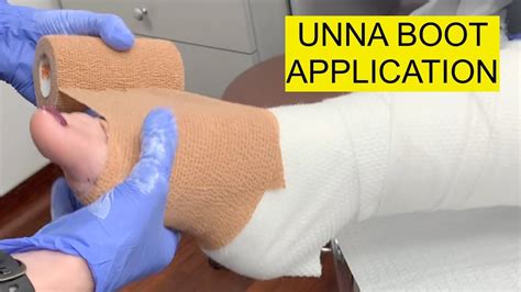 7 Steps To Apply Unna Boot Correctly