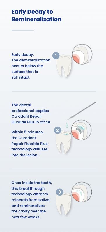 Curodont Application: Expert Guide For Dental Professionals