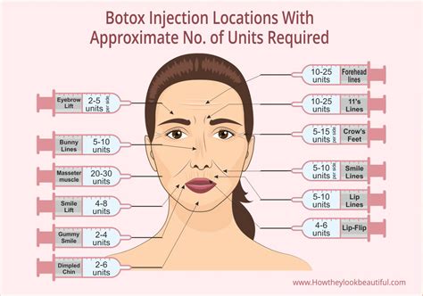 Get Botox For Free: 5 Step Patient Assistance Guide