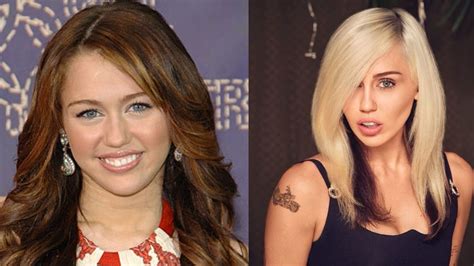 Miley Cyrus 5 Most Dramatic Plastic Surgery Transformations