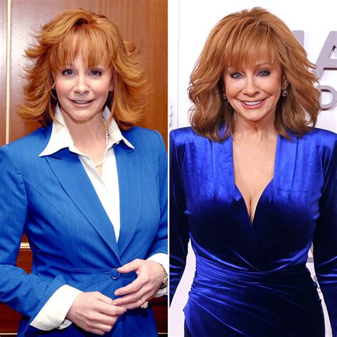 Reba Mcentires 5 Plastic Surgery Secrets Revealed